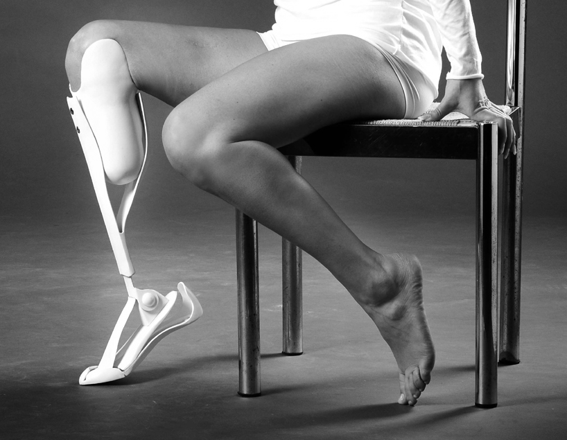 woman beautiful woman prosthetic leg