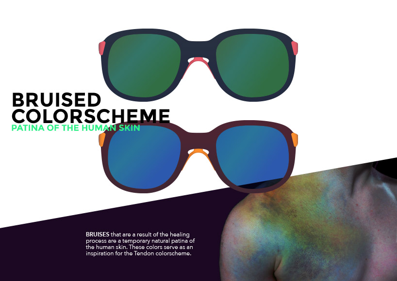 Tendon #getdislocated