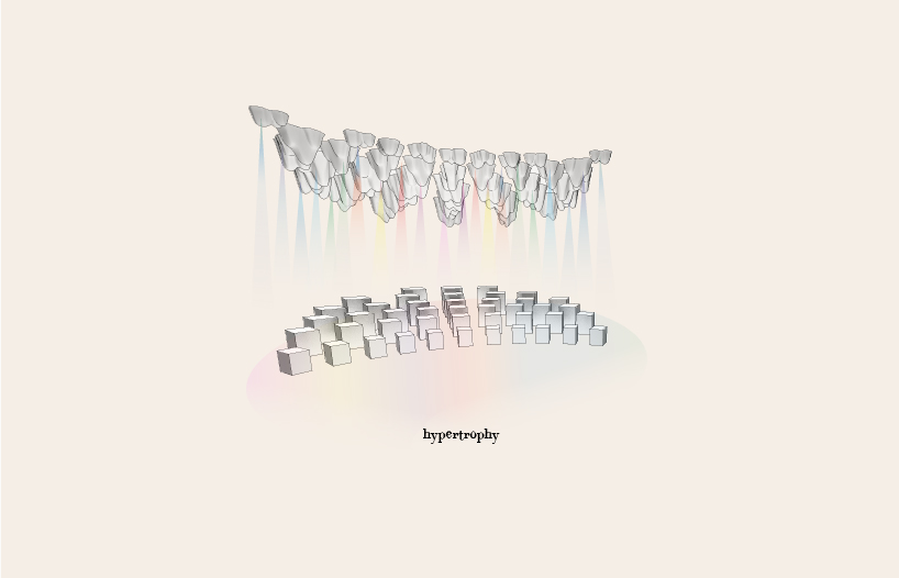 Hypertrophy