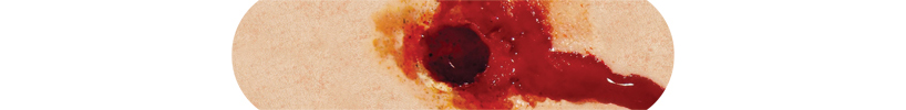 boo-boos, the bandaid that hurts to look at, by sherwood forlee