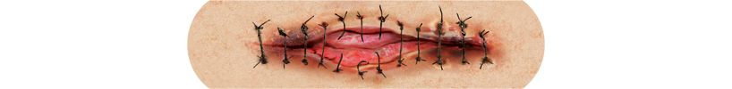boo-boos, the bandaid that hurts to look at, by sherwood forlee