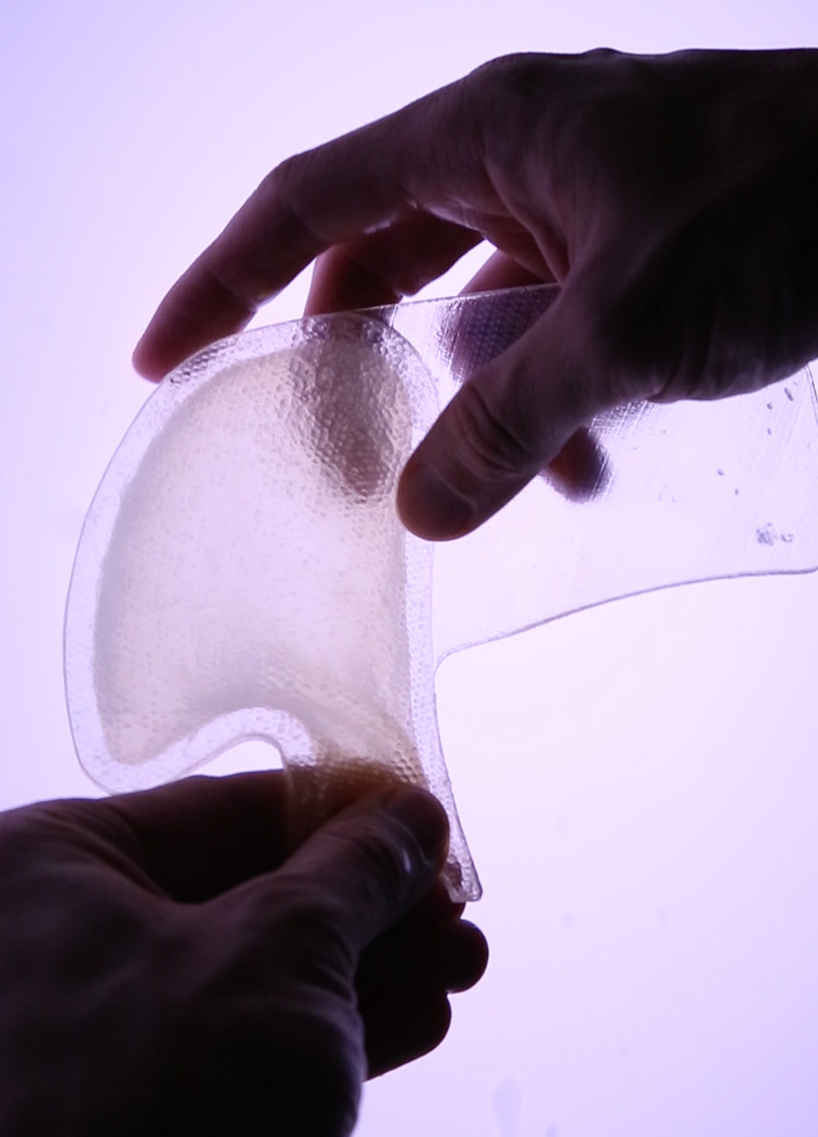 voxel harvest project creates innovative orthotic care devices through metamaterial programming