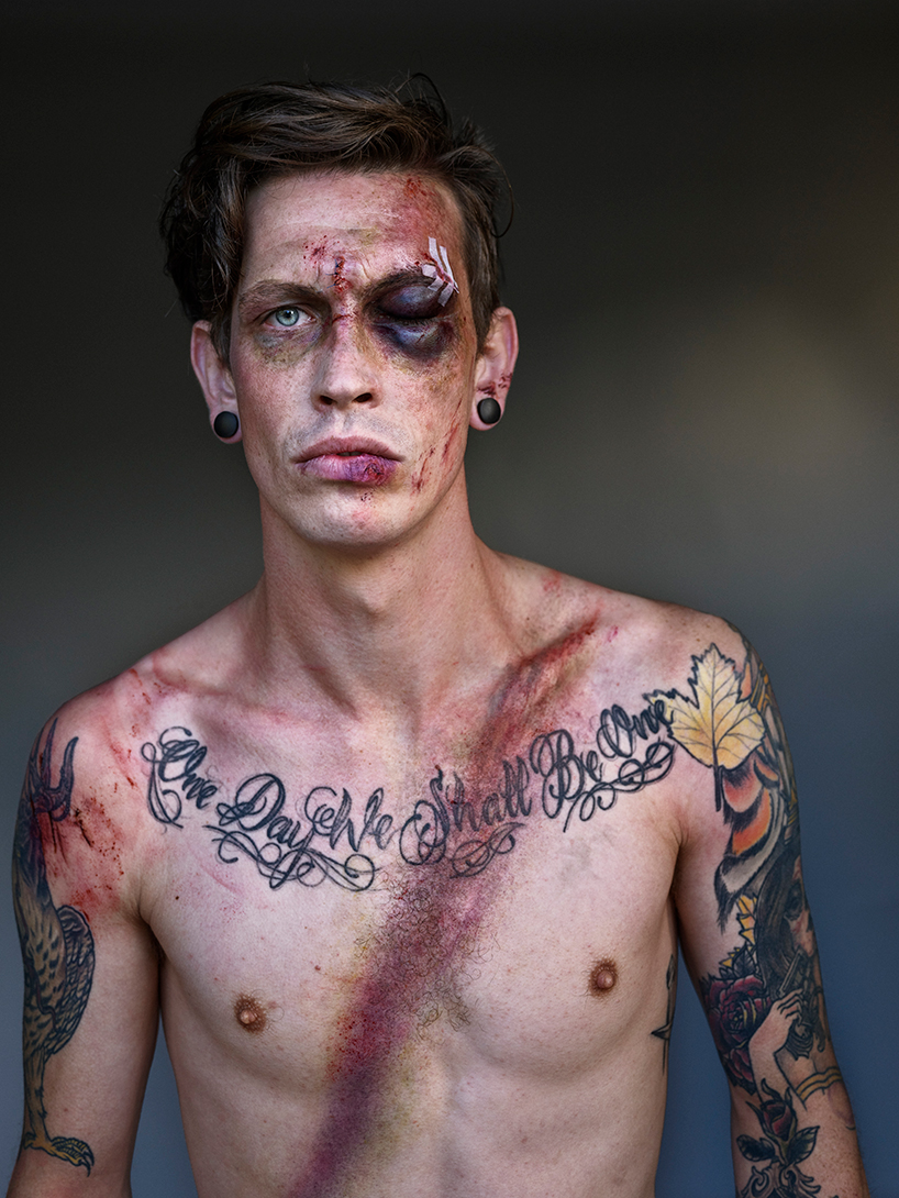 the 'belted survivor' series transforms real seatbelt wounds into badges of honour designboom