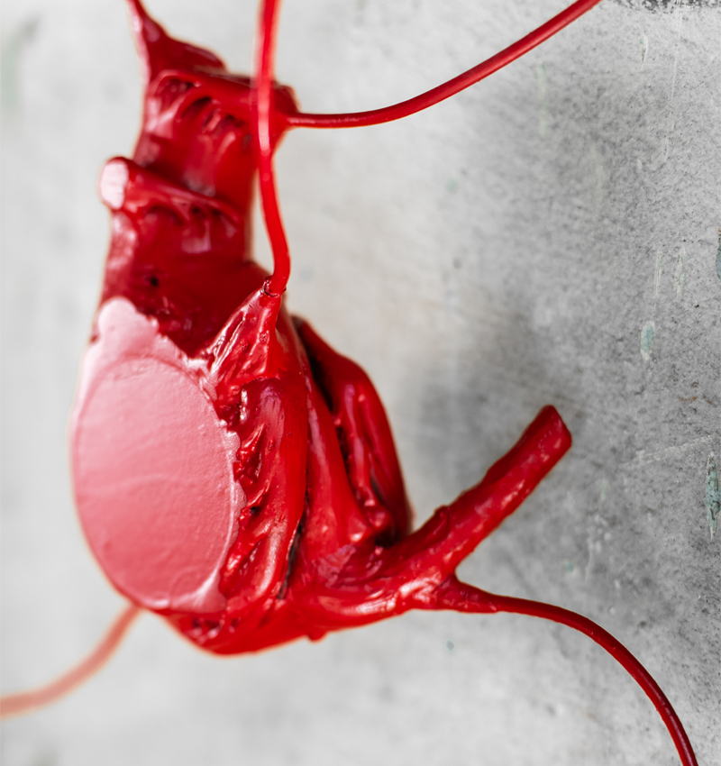 your heart specimen 3