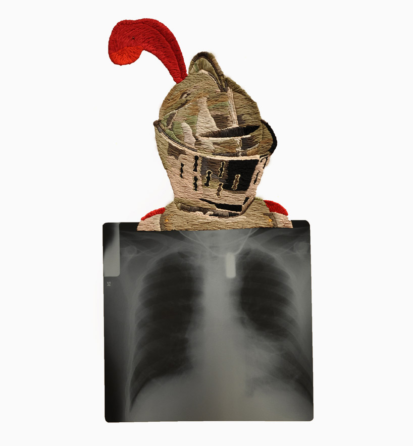 matthew cox embroiders x-rays for thread into plastic