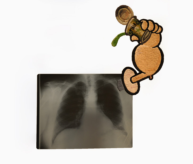 matthew cox embroiders x-rays for thread into plastic