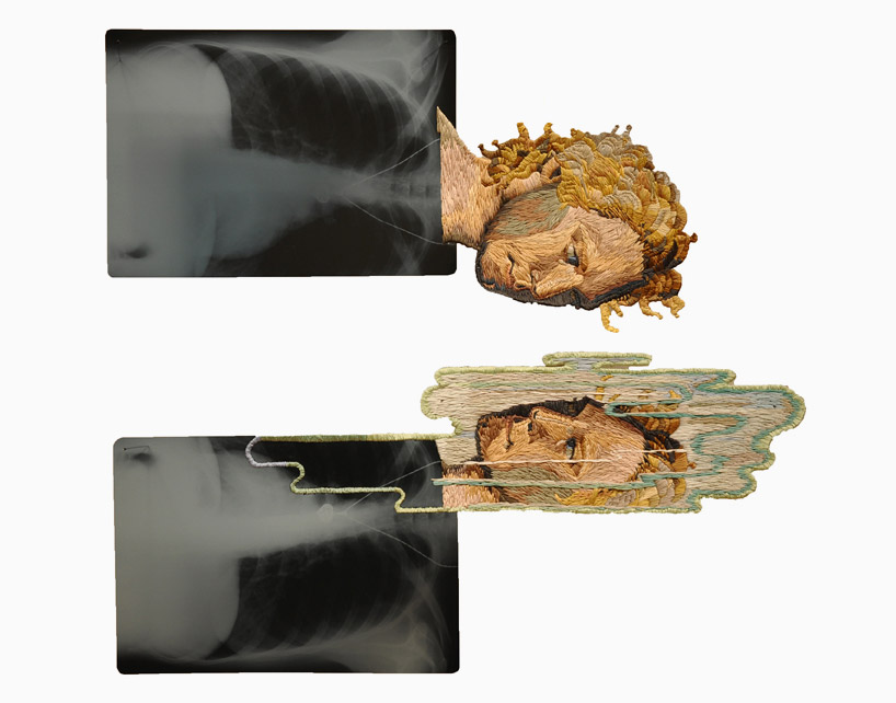 matthew cox embroiders x-rays for thread into plastic