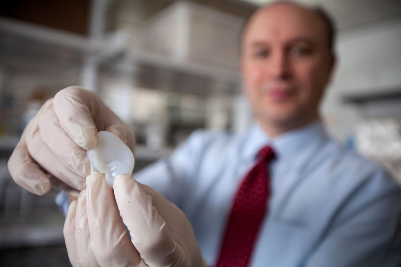 3D printed organs from regenerative living cells