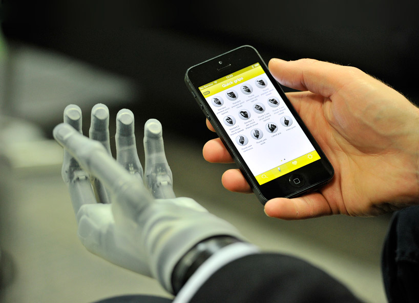 touch bionics app controlled prosthetic hand