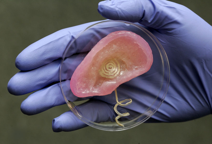 3D printed bionic ear - electronics and biology converge