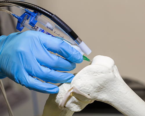 surgeons 3D print stem cells and repair bone with biopen