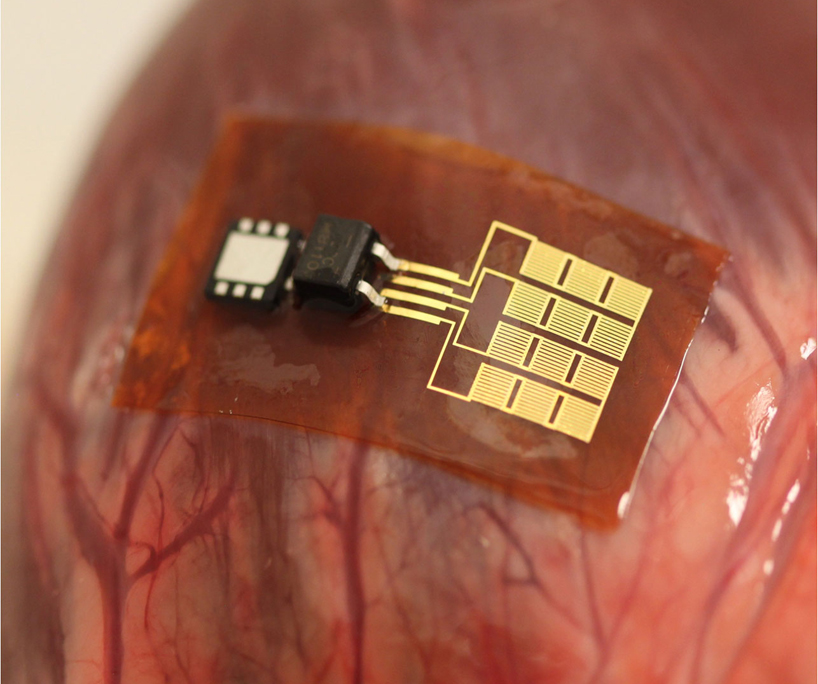 implant implantable piezoelectric harvesting