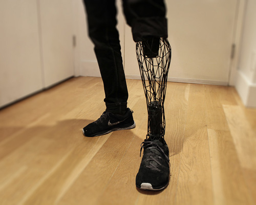 3D printed exo-prosthetic leg becomes a customizable body part