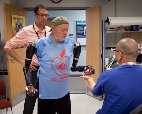 bilateral amputee makes history with APL modular prosthetic limbs
