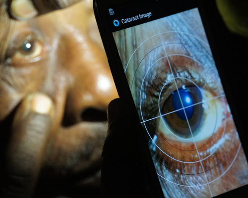 portable eye examination kit peek retina wins 2015 INDEX: award