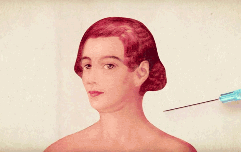 frédéric doazan cosmetically concocts a surgically enhanced supervenus