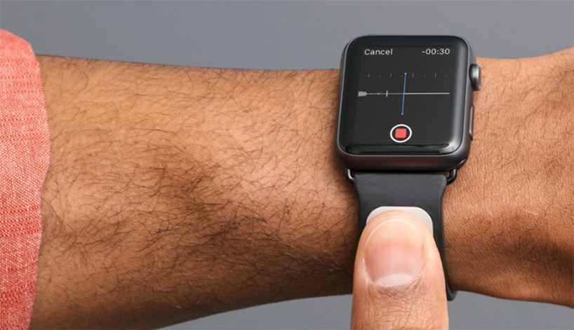 kardia band for apple watch tracks vitals to instantly detect symptoms of a stroke