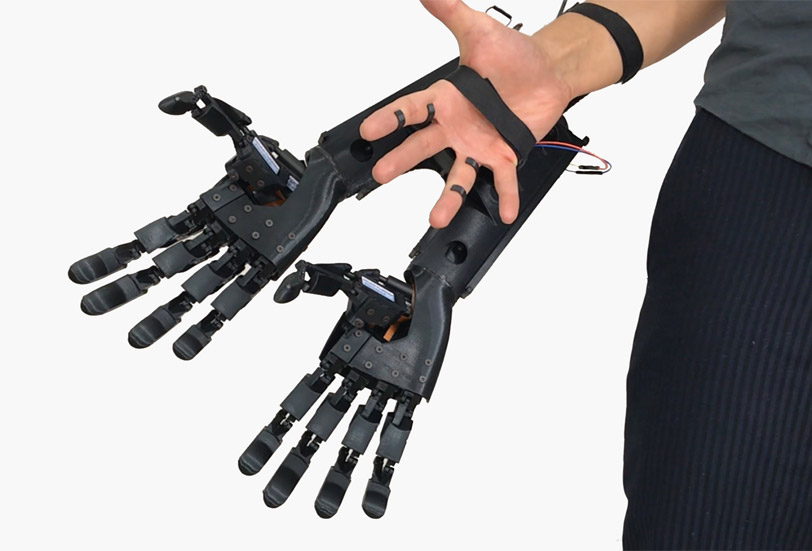 3D printed hand builds first augmented human