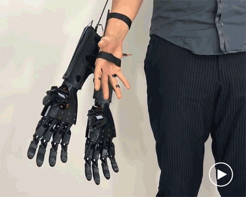 youbionic's 3D printed double hand builds first augmented human
