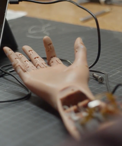 'unlimited tomorrow' to 3D print 20 prosthetics for the price of 1