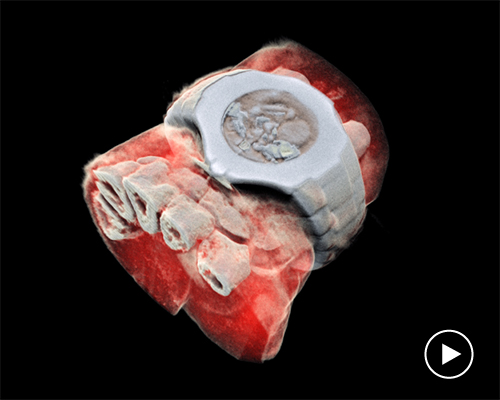 the world's first full-color, 3D X-ray shows far more than just your bones