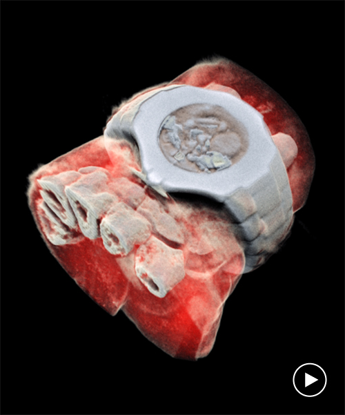 the world's first full-color, 3D X-ray shows far more than just your bones