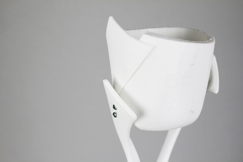 student develops prosthesis that helps ballerinas perfect technique