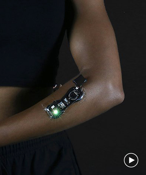 electrodermis is a fully-untethered, stretchable and customizable electronic bandage