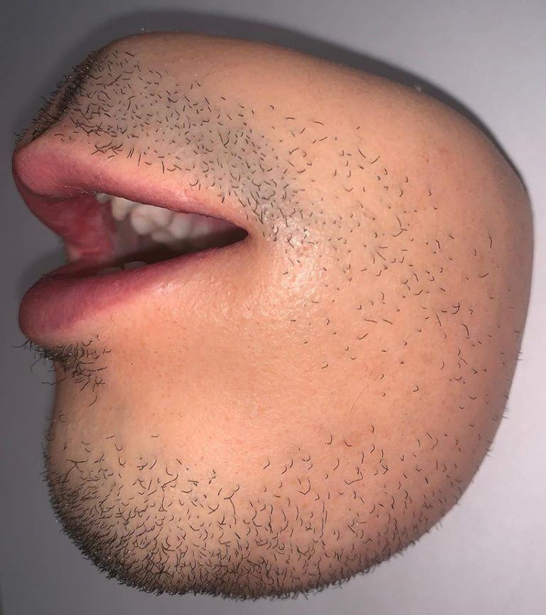 fleshy coin purse is sending shivers down the spine of the