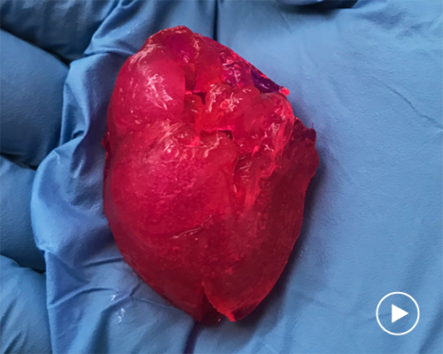chicago-based biotech company has 3D printed a miniature human heart