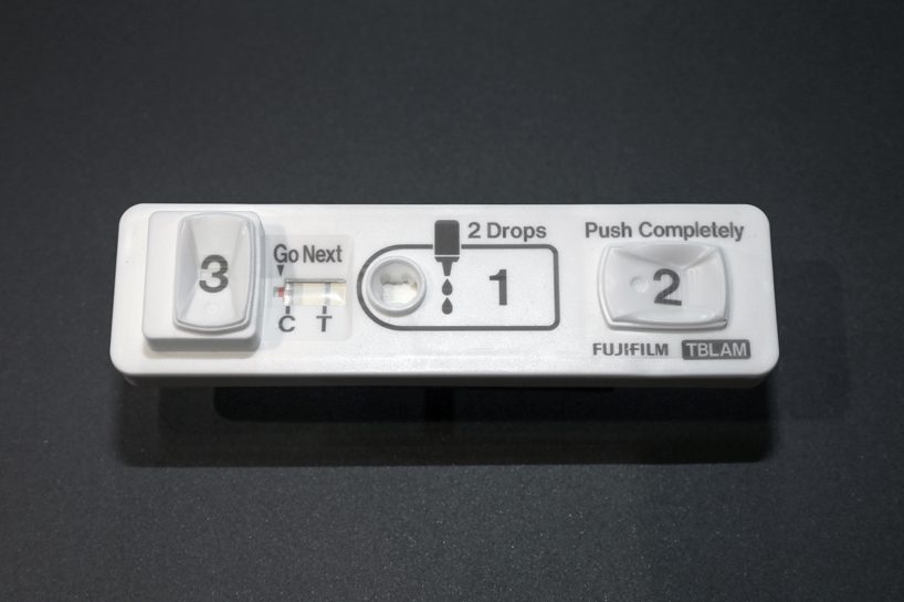 rapid diagnostic kit for tuberculosis wins 2019 japan GOOD DESIGN grand award
