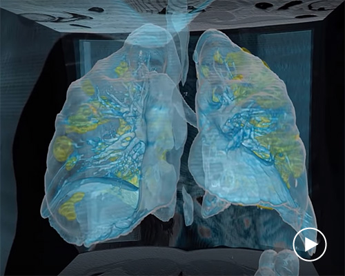 virtual reality (VR) technology in the fight against COVID-19 at george washington university hospital