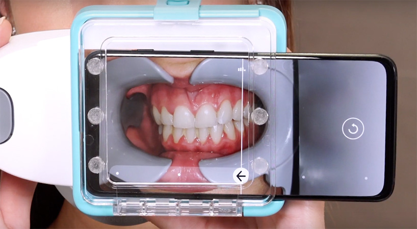 scanbox, the dental scanner that sends images of your teeth to your dentist