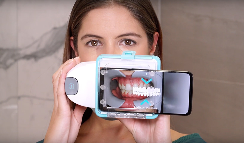 scanbox, the dental scanner that sends images of your teeth to your dentist