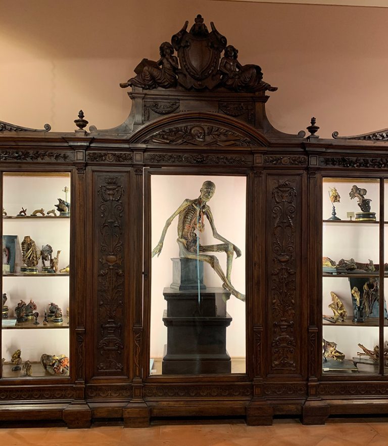 the anatomy museum in naples surveys both normal anatomy and anatomic