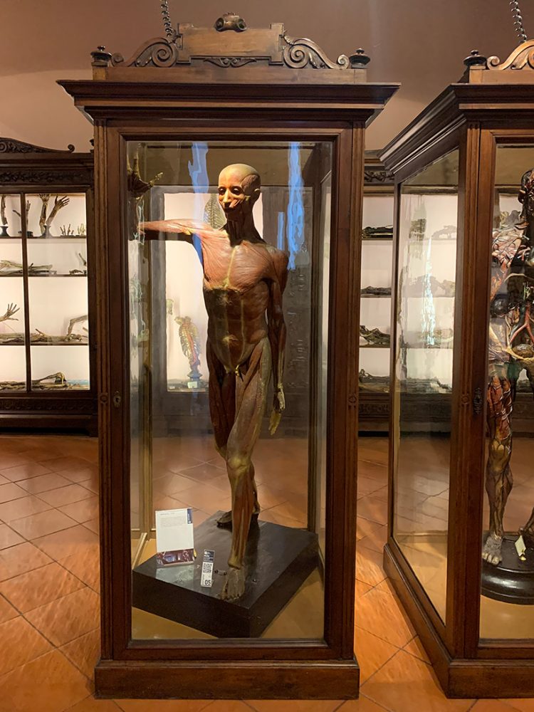 the anatomy museum in naples surveys both normal anatomy and anatomic