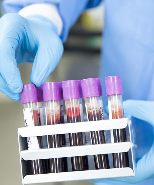researchers say mass blood tests could help combat the coronavirus pandemic