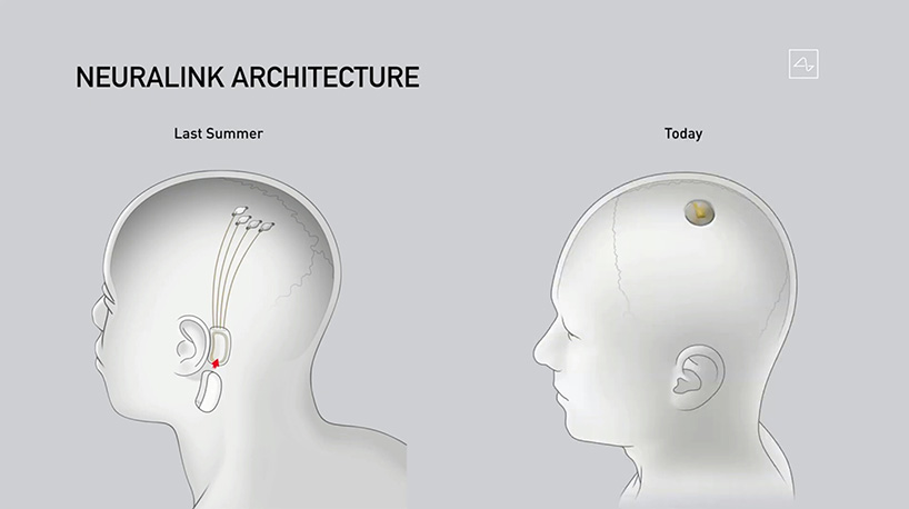 elon musk's neuralink unveils brain implant update and the surgical robot to insert it