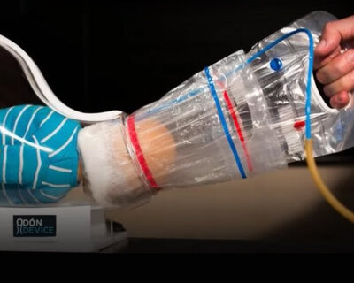 the odon childbirth device was inspired by a corked wine bottle hack