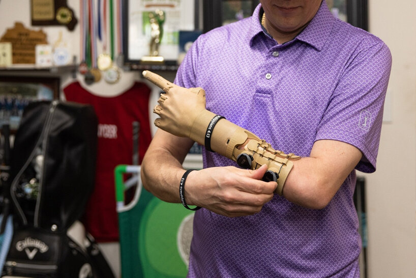 TrueLimb is an affordable prosthetic that uses 3D scanning for a perfect fit
