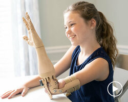 aviya serfaty: prosthetic leg for women