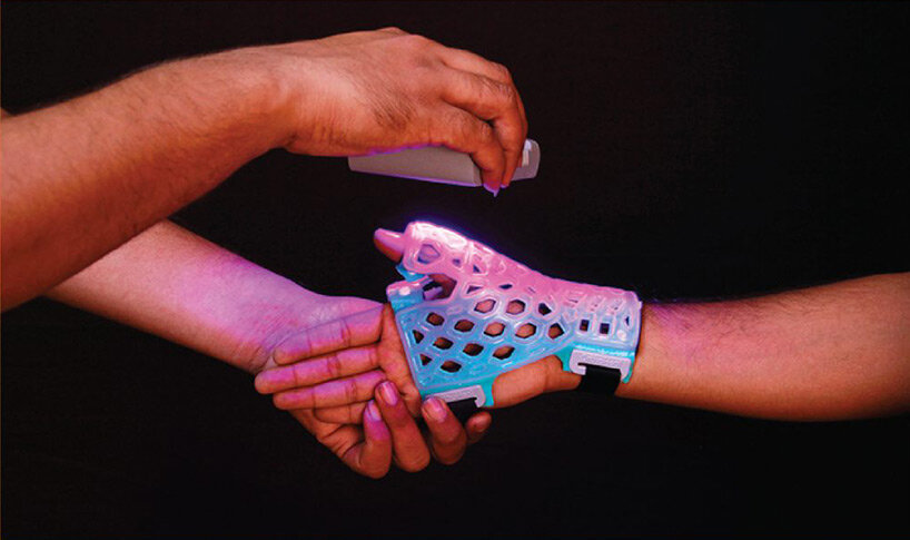 washable & breathable flexiOH cast adapts to the patient's skin