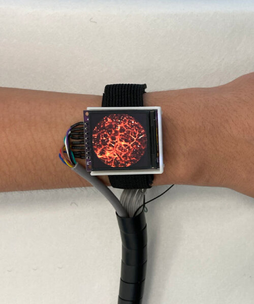 high tech watch takes photos of blood vessels real-time to monitor heart rate anywhere