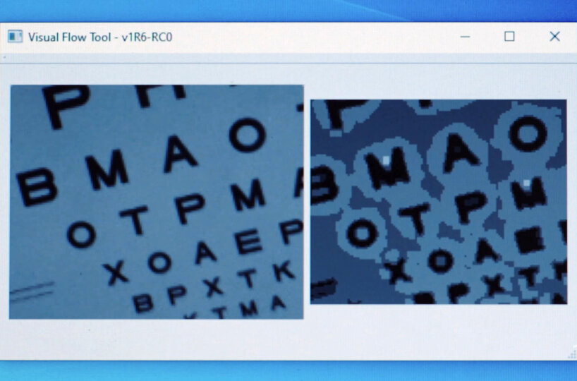 La vista que el paciente puede ver (derecha)