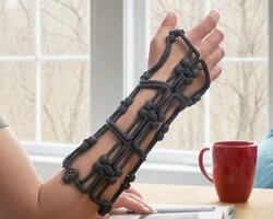 foldable medical brace adapts to user’s injured arm using adjustable cables