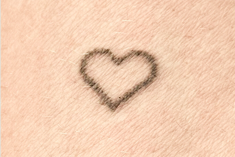 microdot tool offers painless permanent tattoos to those with blood and needle phobias - 2